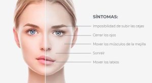 Parálisis facial en clínica JMS